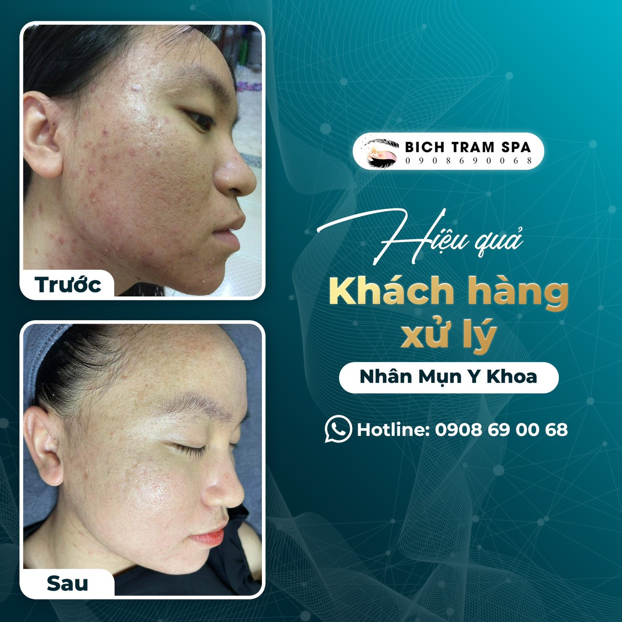 Phun xăm mỹ